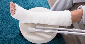 Elevated View Of Man's Broken Leg In Cast; blog: 10 Common Types of Bone Fractures